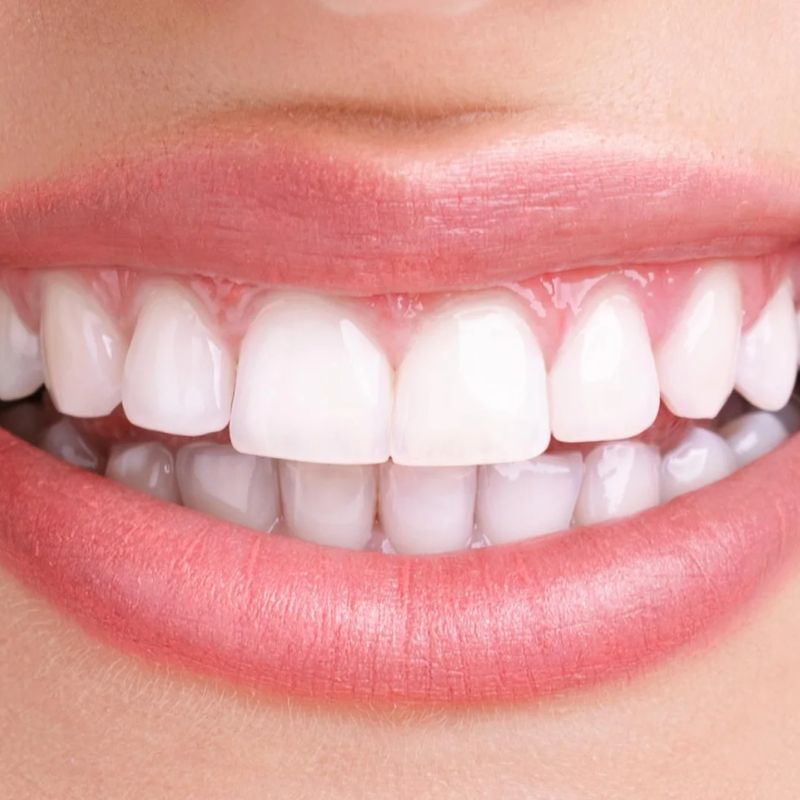 दात — Teeth