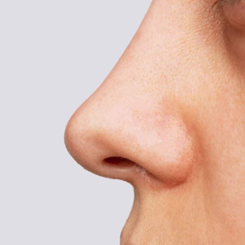 नाक — Nose